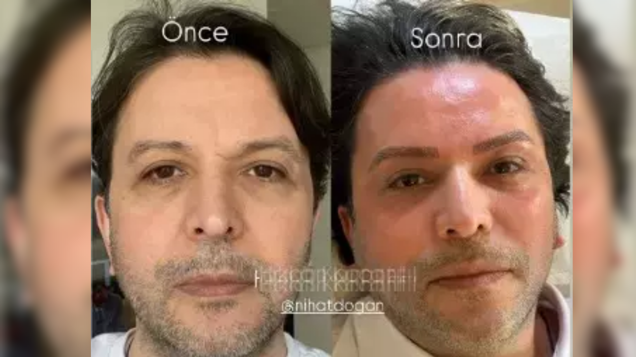 Estetikle Tanınmaz Hale Geldi