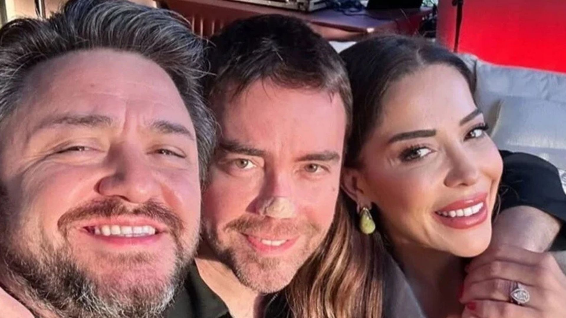 Murat Dalkılıç Son Halini Paylaştı 11 Kez Burnundan Ameliyat Oldu!2