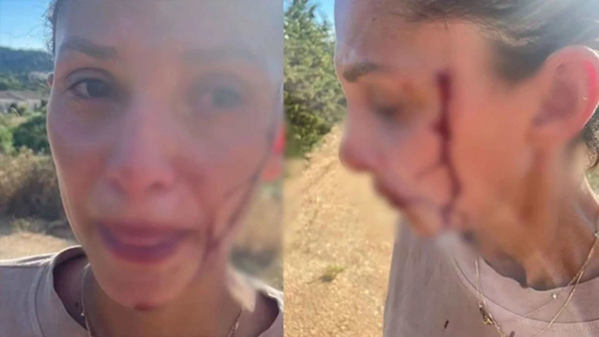 Can Yaman’ın Sevgilisi Sara Bluma’dan Çarpıcı Açıklama Şiddet Gördüm, Artık Susmayacağım (2)