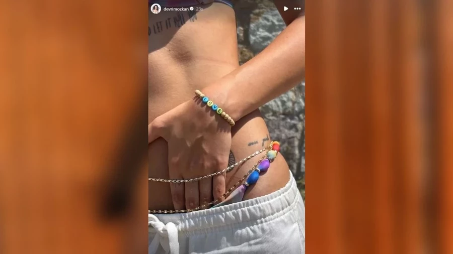 De Igs0