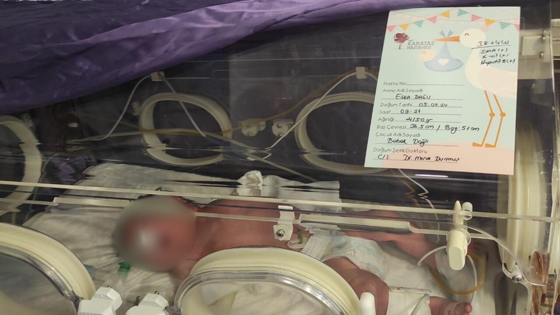 İzmir’de Yoğun Bakım Skandalı Minik Vedat 1 Yıldır Komada3