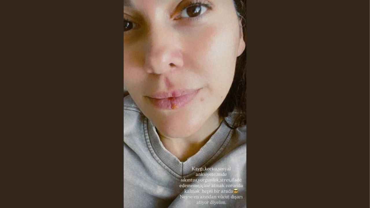 Bergüzar Korel'den Samimi Itiraf Kaygı Ve Stresin Etkileri (2)