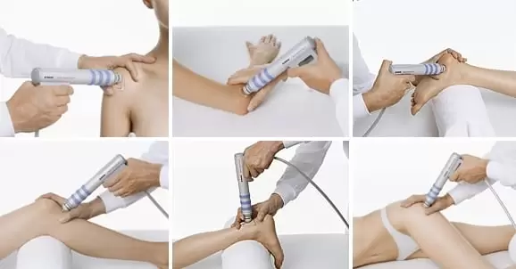 Elektronik Şok Dalga Tedavisi E S W T