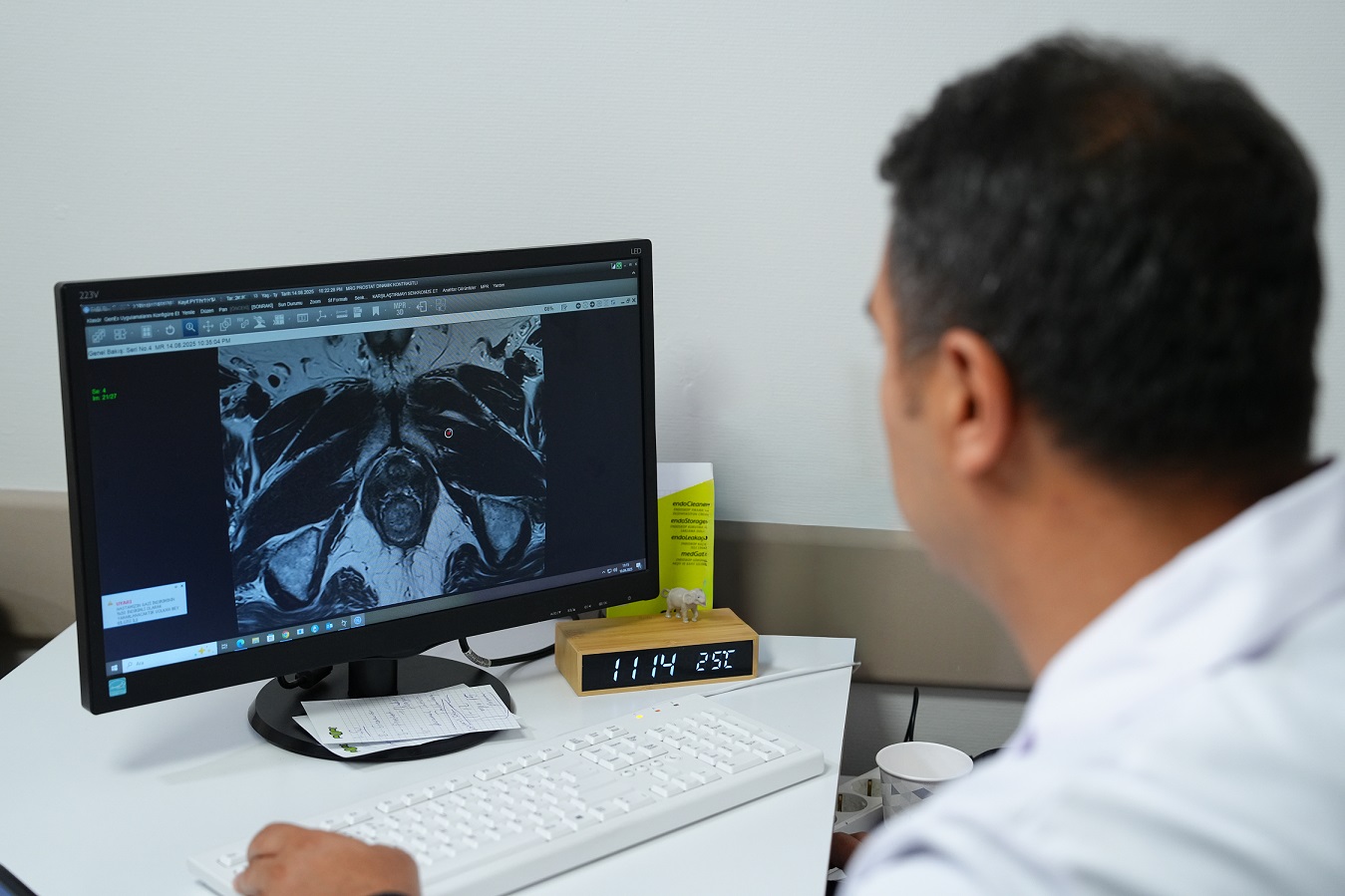 ‘ F U Z Y O N B I Y O P S I I L E T U M O R O D A K L A R I H E D E F 920398 273521