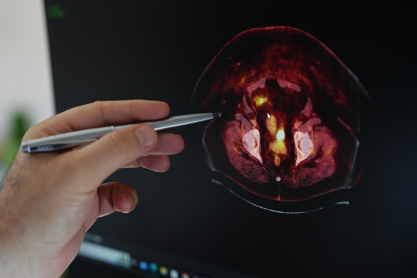 ‘ O B E Z I T E E N D O M E T R I U M K A N S E R I R I S K I N I A R 930958 276541