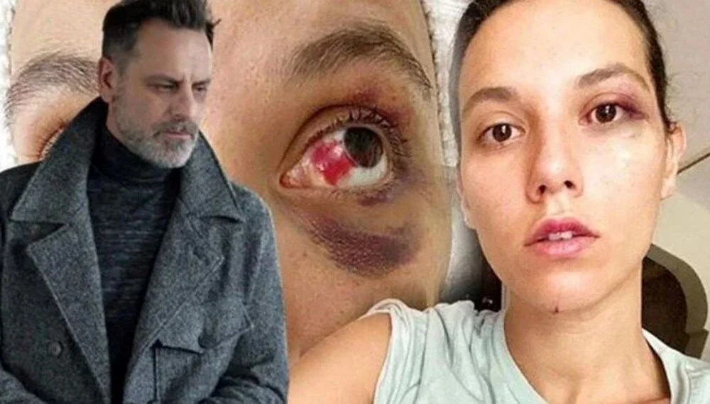 Fq4Fn U55A E Su Q V Rr F J Vrw.jpg