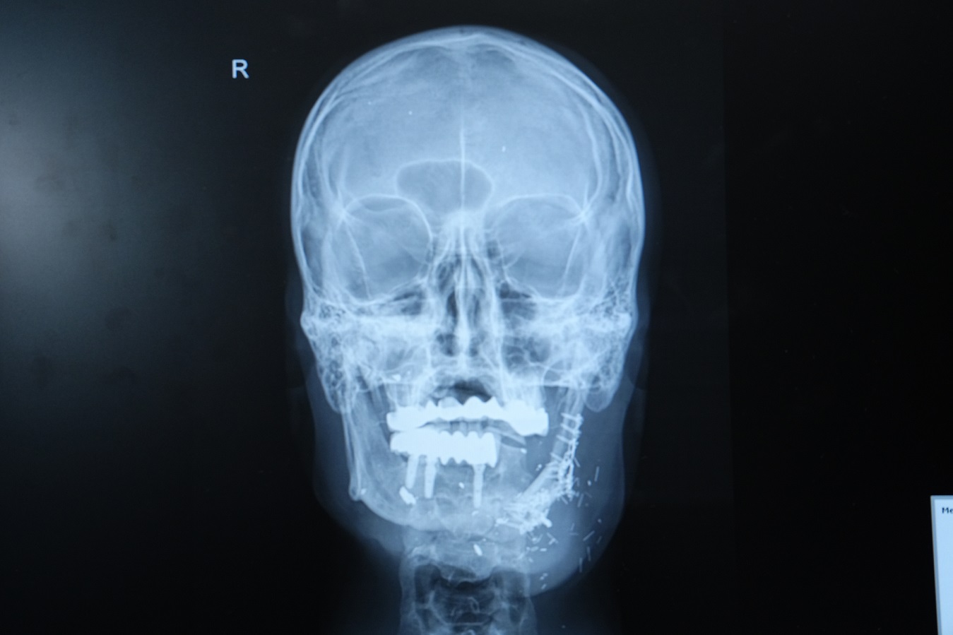 S I L A H L I Y A R A L A M A S O N U C U C E N E S I N I N Y A R I S I 983714 292027