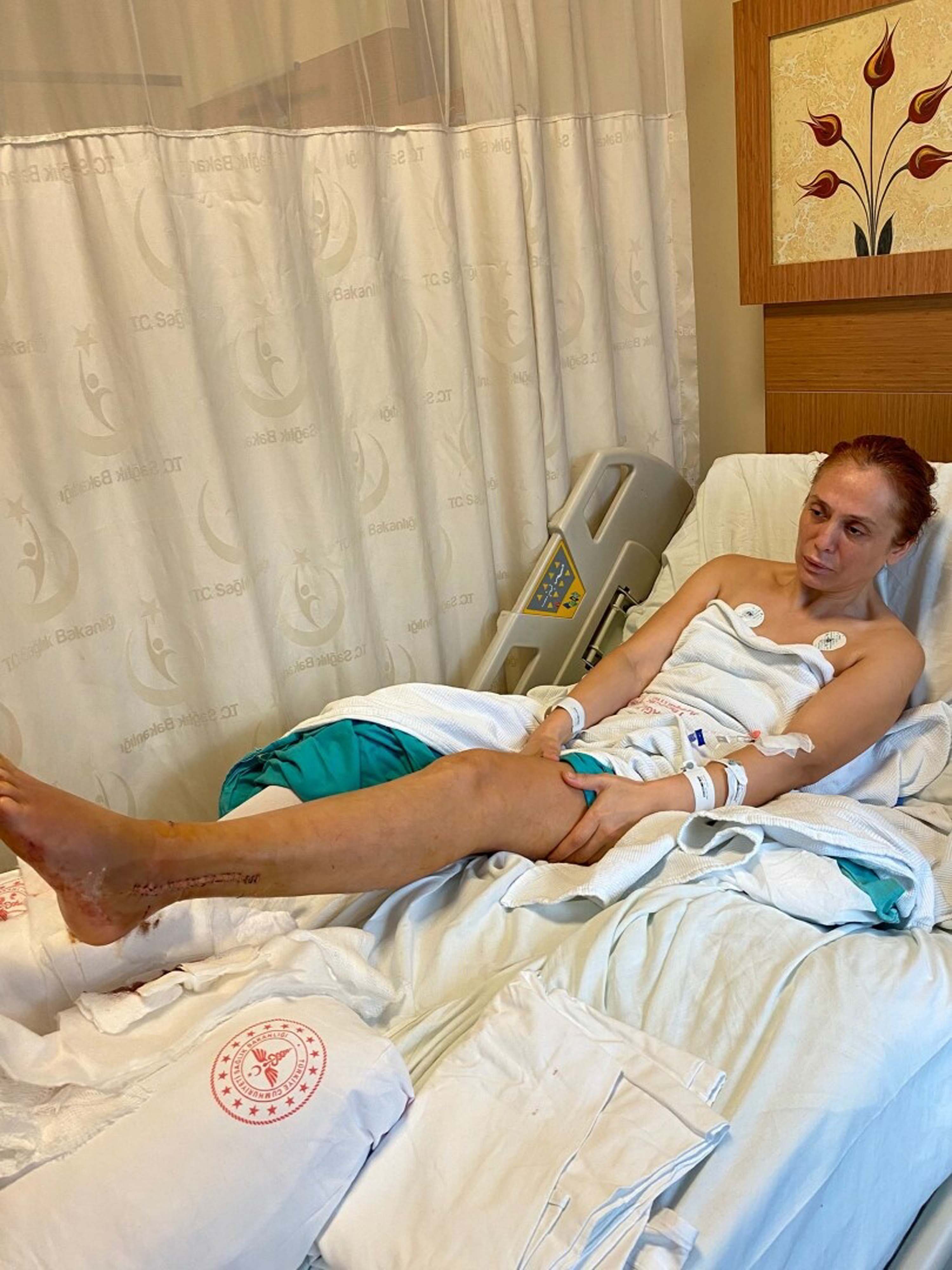 E S K I E S I N I N O T O M O B I L L E C A R P I P A G I R Y A R A 999913 296679