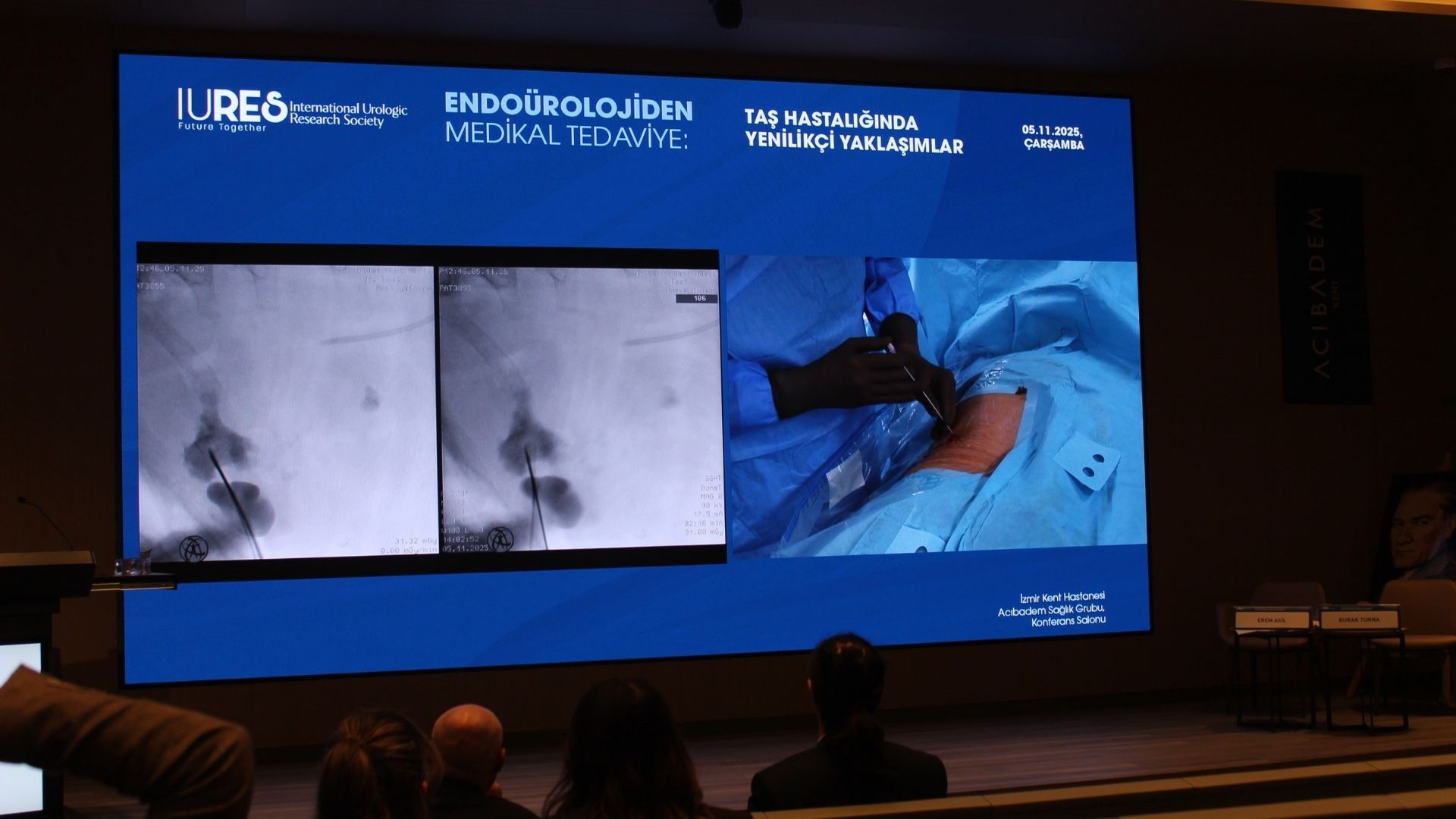 Endoüroloji Hızla Dönüşüyor Robotik Sistemler Cerrahide Yeni Dönem Başlatıyor (1)