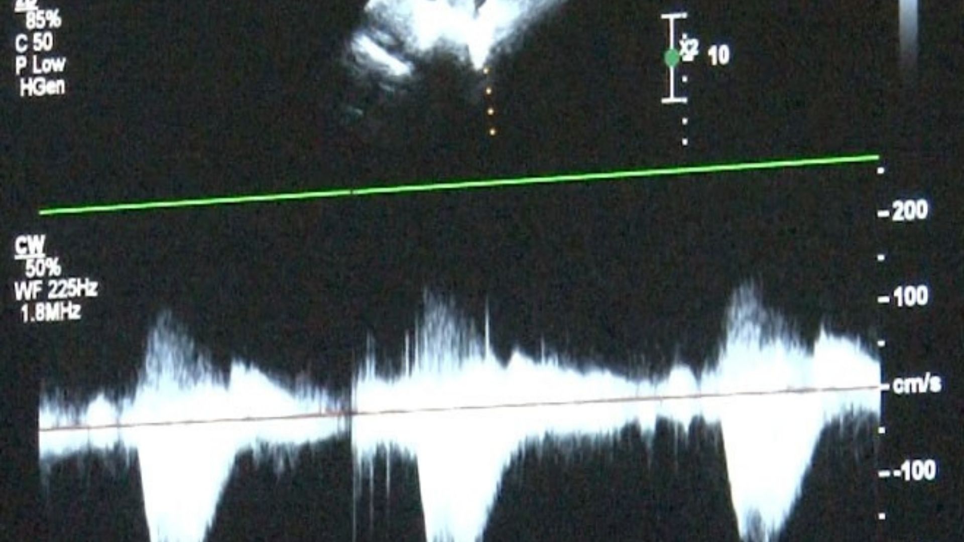 Uzmanlardan Çocuklarda Kalp Sağlığı Uyarısı Takipleri Düzenli Yaptıralım (2)