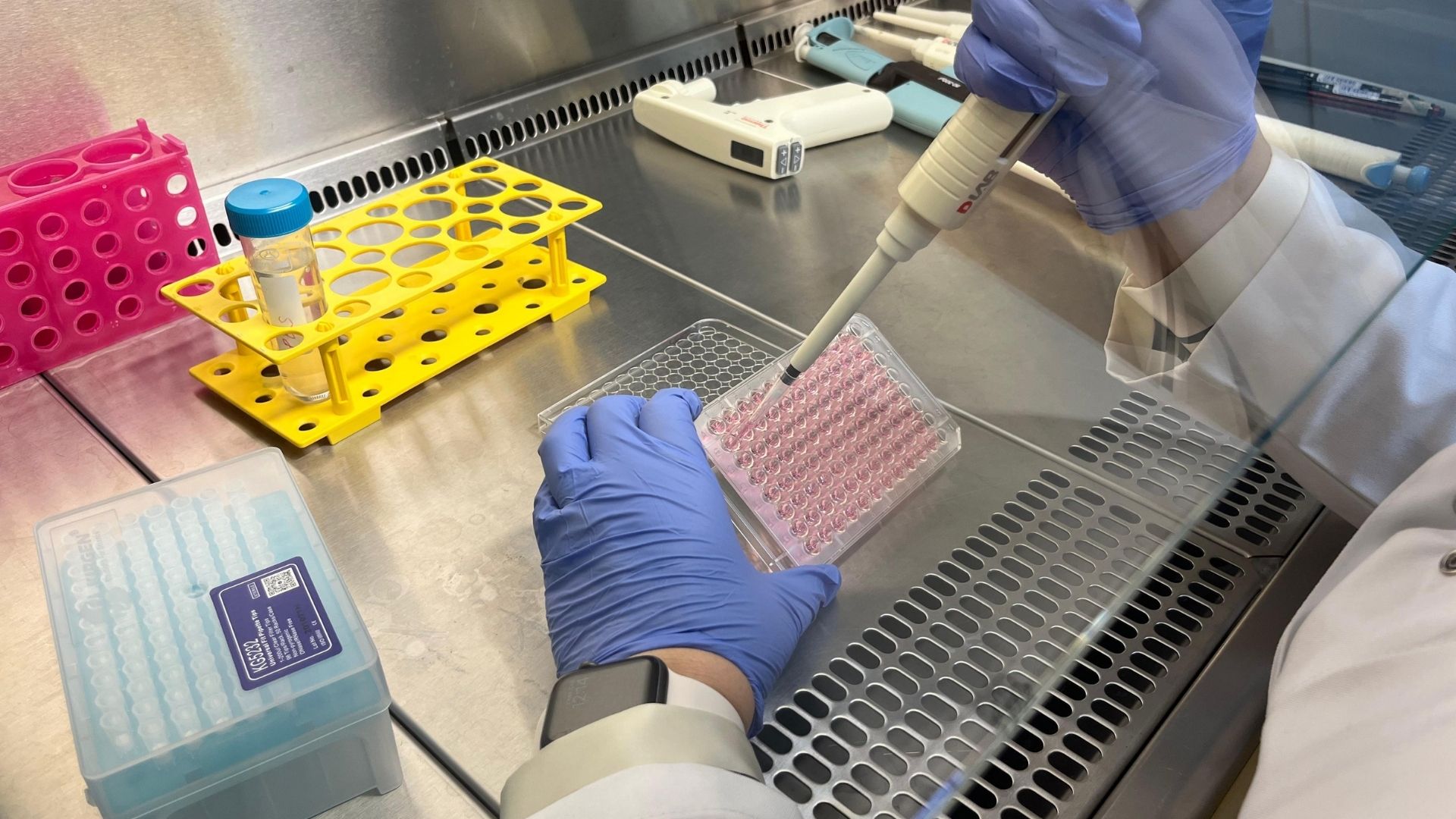 Parkinson Araştırmalarında Yeni Dönem (1)