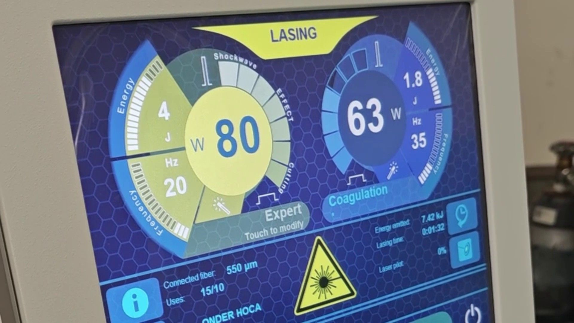 Prostat Büyümesinde Holep Yöntemi Hastalara Kesin Çözüm Sunuyor (1)