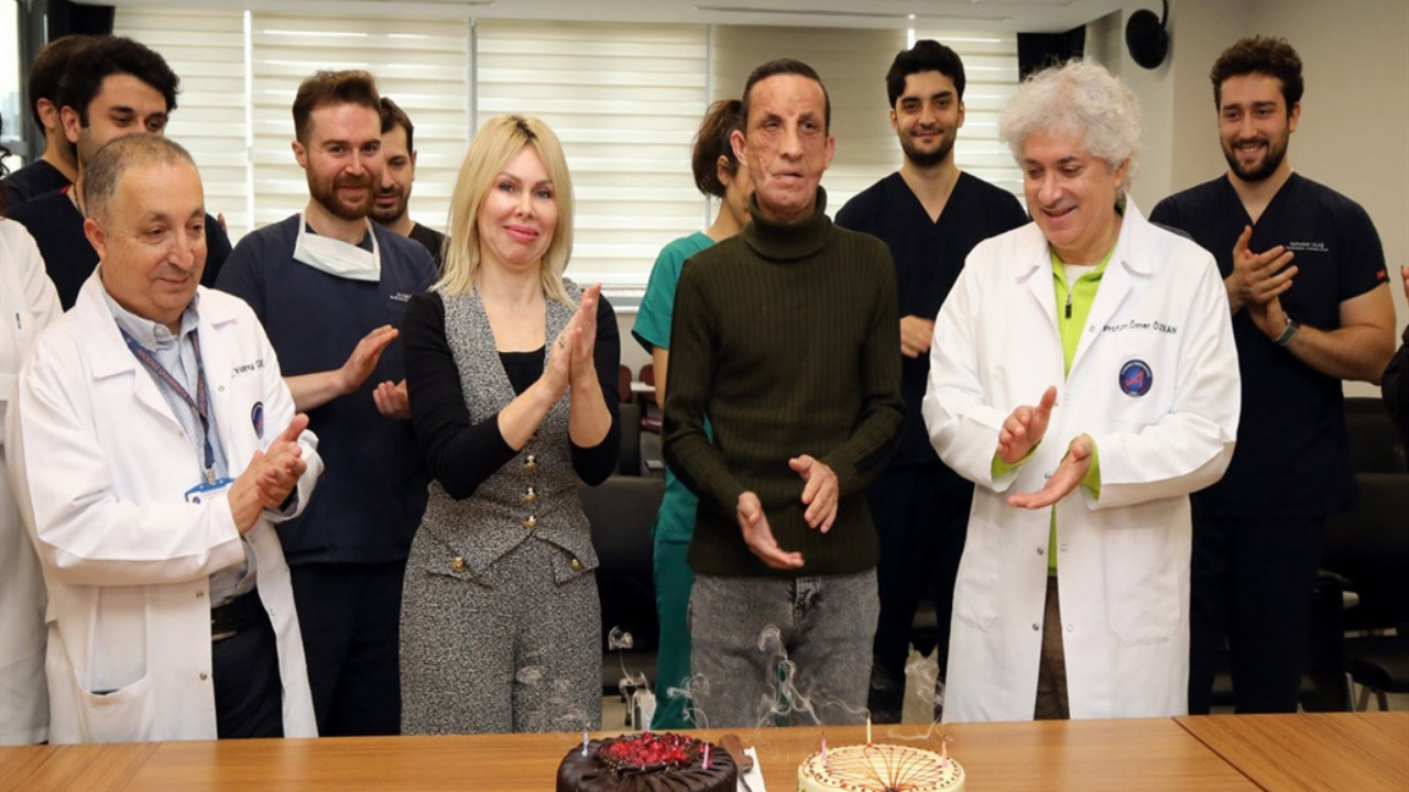 İlk yüz nakilli Uğur Acar-1