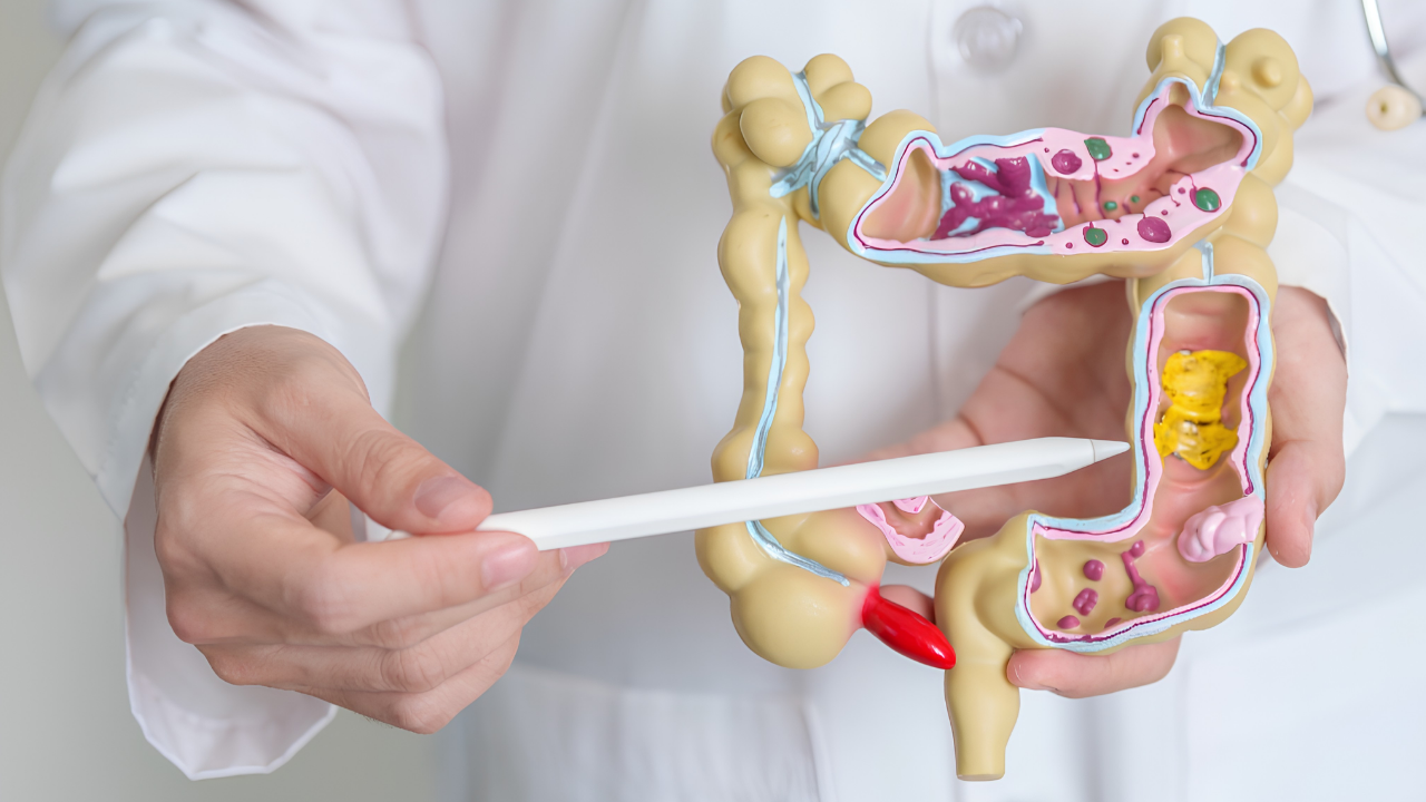 Bağırsak kanserinde erken uyarı işaretleri: Belirtiler neden kritik?