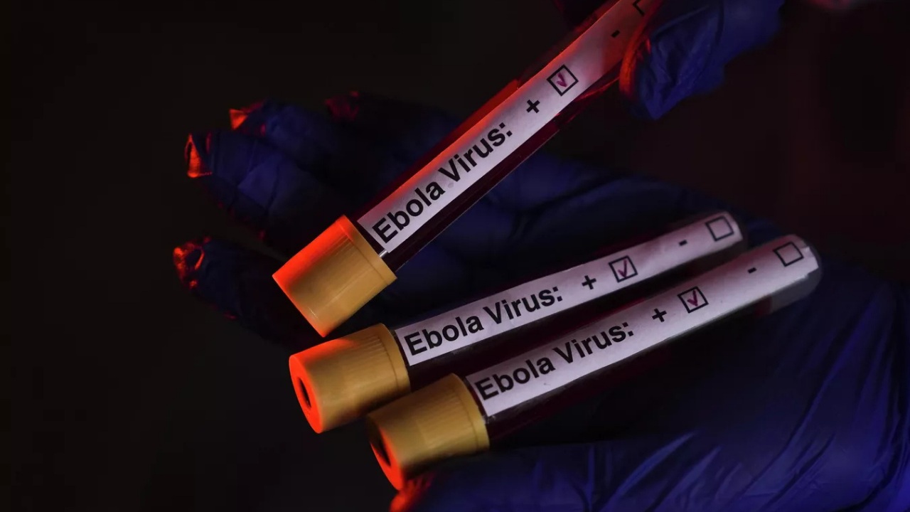 Ebola Virüsü